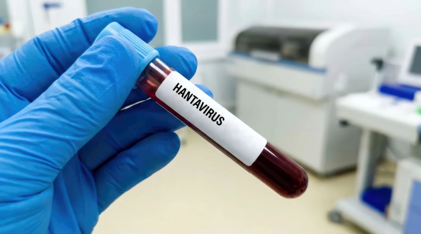 Kann das neue Hantavirus die Weltwirtschaft beeinflussen?